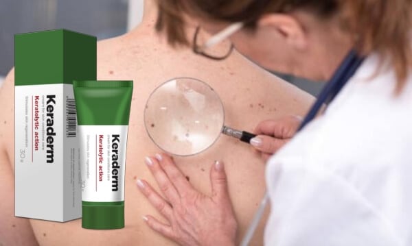 Keraderm ¿Cómo funciona?